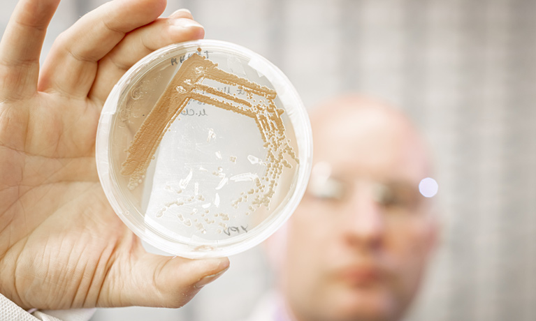 Close up of a lab specimen dish being held up toward the camera.