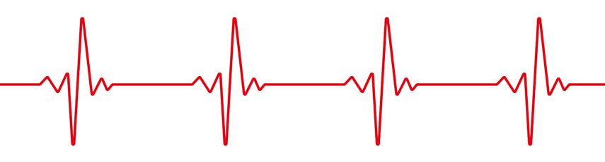 Comparison of RR intervals and heart rate variability between disposable and reusable electrocardiography leads