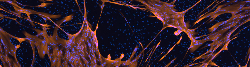 Concentration or composition that is the question! How do exogenous fatty acids contribute to changes in metabolic flexibility of skeletal muscle?