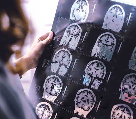 Person holding a sheet of black and white brain MRI scans with multiple cross-sectional images.